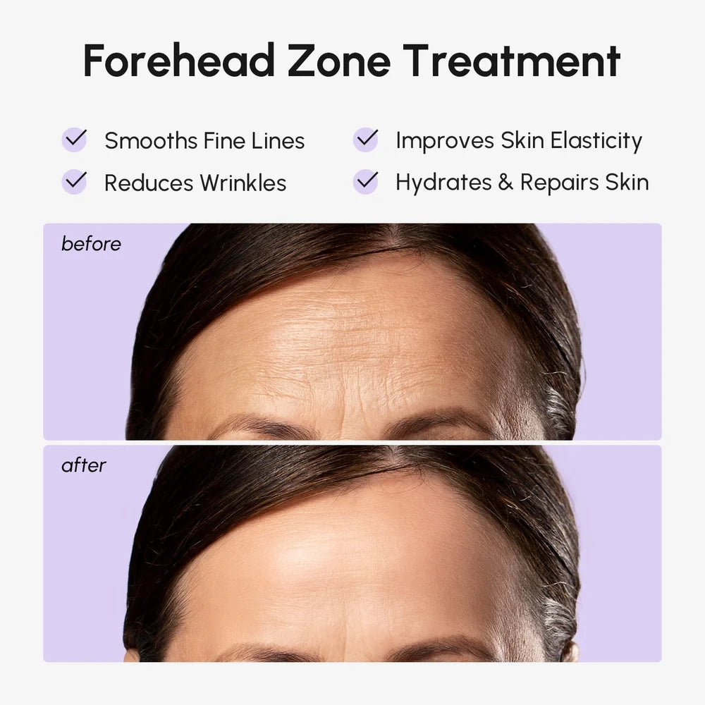 Marée® Forehead Smoothing Patches